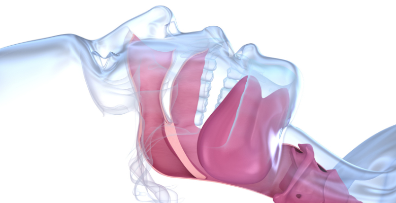 Apneia do sono e deglutição: estudo português em destaque no ESSD 2025