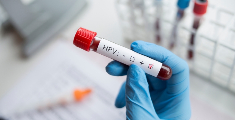 Cancro da orofaringe associado ao HPV está a aumentar em vários países, incluindo Portugal